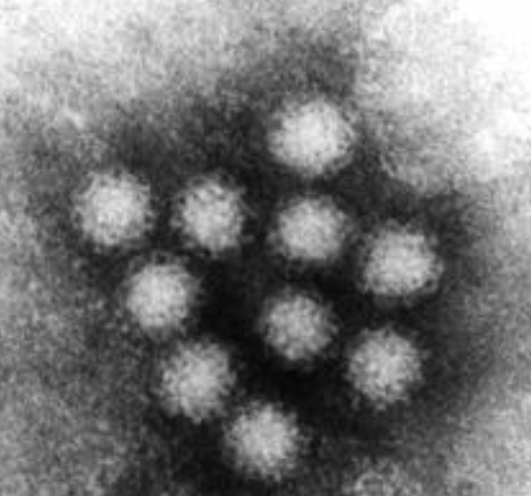 صورة مجهرية لnoravirus