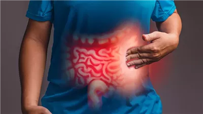كل ما تريد معرفته عن القولون العصبي 