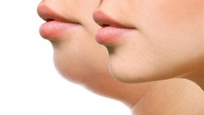 تنحيف الوجه في ايام معدودة بخلطة طبيعيه 