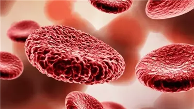 ټسمم الډم : اكتشف الأسباب والأعراض واستراتيجيات العلاج