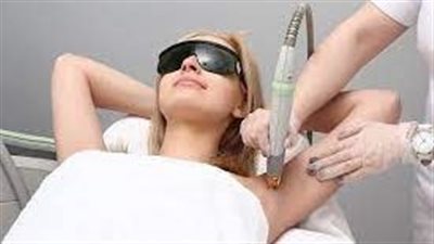 تكلفة إزالة الشعر بالليزر: ما هي العوامل التي تؤثر عليها؟