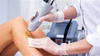 إزالة الشعر بالليزر: تقنية آمنة وفعالة لإزالة الشعر غير المرغوب فيه