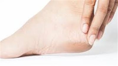طرق طبيعية لتنعيم القدمين