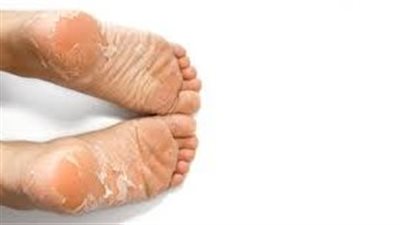 خطوات تنظيف قدميك من الجلد المېت