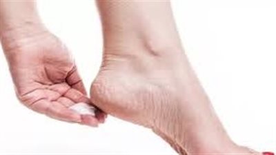 طرق التخلص من شقوق القدمين في المنزل