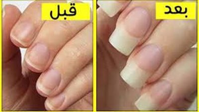 رغبة البعض في تطويل الأظافر بسرعة.