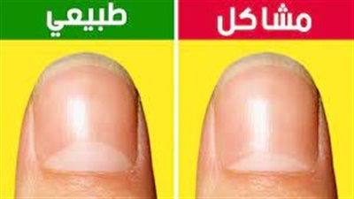 الصحة من لون الأظافر: نظرة ثاقبة على ألوان الأظافر ودلالاتها
