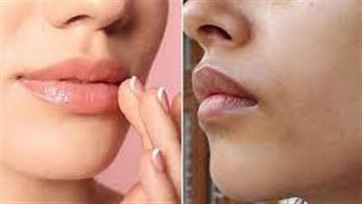 وداعاً للسواد حول الفم: استراتيجيات فعّالة للحصول على ابتسامة ساحرة