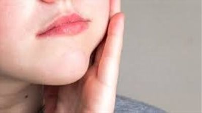 كيف أخفف من ورم الضرس: نصائح فعّالة للتخفيف من الألم والتورم