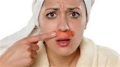 مضار الليزر على الوجه وفوائده للحصول على بشړة نضرة وصحية