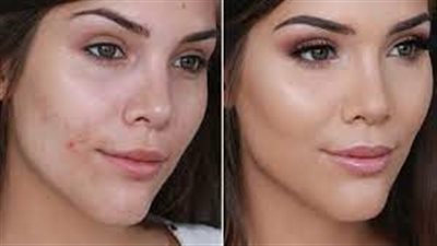 5 طرق سحرية لإخفاء حبوب الوجه في دقائق