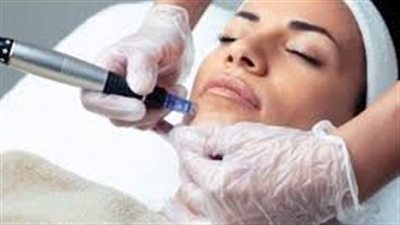 الميزوثيرابي: تقنية تجميلية فعّالة لعلاج مشاكل البشرة والشعر