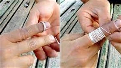 طريقة إزالة الخاتم من الإصبع