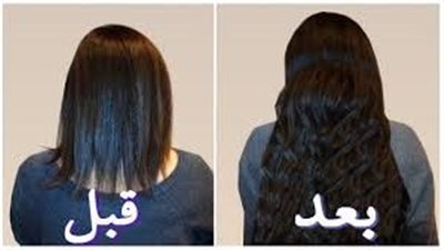 مغامرة في عالم الطبيعة: الثوم لعلاج تساقط الشعر