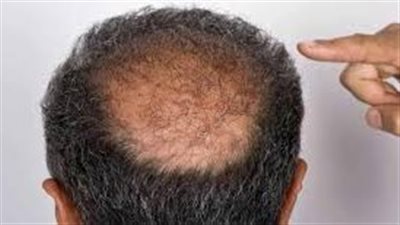 نصائح عملية لتعزيز نمو شعر الرجل وحمايته من التساقط