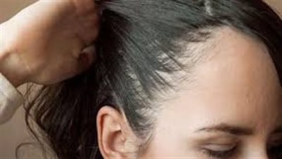 وداعاً للشعر الخفيف في الأمام: أفضل خلطة لزيادة كثافة شعرك