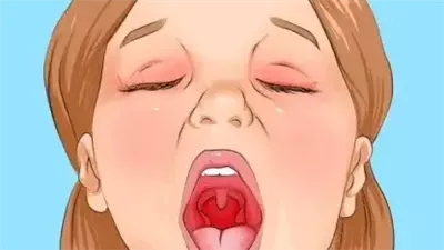 أمراض تصيب الأطفال تكون أعراضها مشابهة لأعراض الإنفلونزا