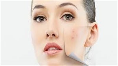 وداعاً للتصبغات: أسرار الحصول على بشړة موحّدة اللون