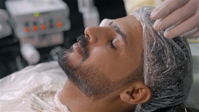 فوائد تنظيف البشرة للرجال بالليزر