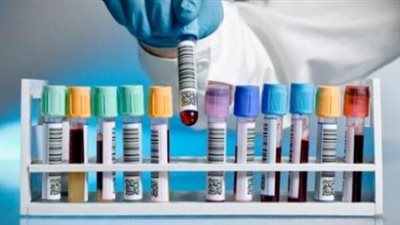 افضل تعبير عن انواع التحاليل الطبية واختصاراتها