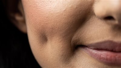 طريقة عمل غمازات حقيقية وطبيعية بدون عمليات مجربة