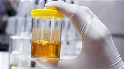دلالة حلم البول للمرأة لابن سيرين
