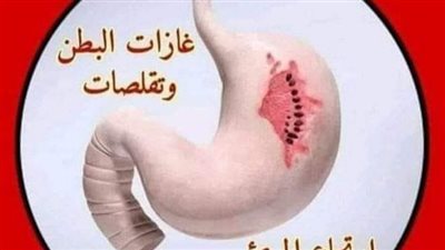 لكل من يعاني من اعراض القولون العصبي وجرثومة المعدة