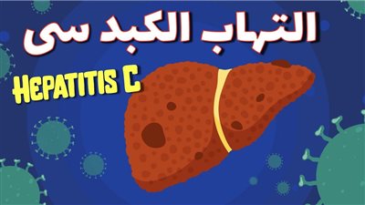 التهاب الكبد C : الأعراض والعلاج