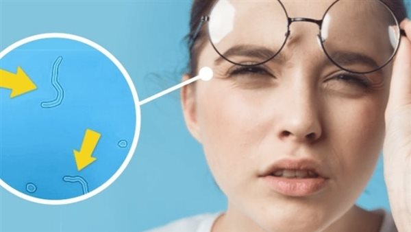 رؤية العوامات، الخطوط