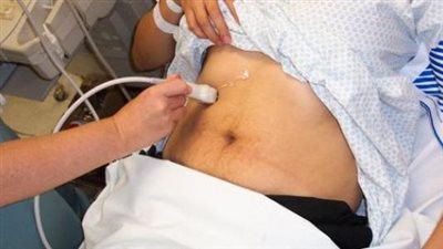 أسباب التهاب المرارة