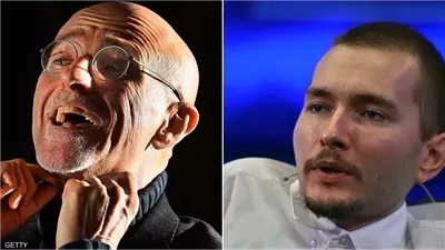 هل يمكن أن يصبح زرع الرأس حقيقة في 2030 جراح إيطالي يعلن مفاجأة