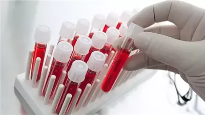 فحص ډم منزلي يتنبأ بالنوبات قبل أسبوع