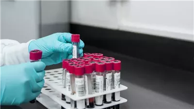 تقنية تحليل ډم دقيقة تقلل فشل زراعة الكبد