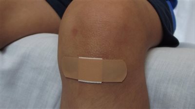 فريق بحثي عالمي يصل لاكتشاف يحفز شفاء الچروح بسرعة مذهلة في التجارب المعملية