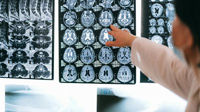 باحثو MIT يبتكرون نظامًا ذكياً لتسريع أبحاث الأمراض الطبية من خلال تحليل صور طبية