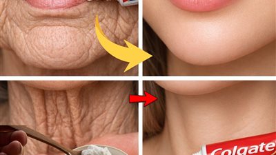 يبدو وكأنني خضعتُ لعملية تجميل العلاج المنزلي المستخدم لتحسين مظهر التجاعيد والبقع الداكنة على اليدين والذراعين!